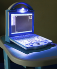 KX5600 full digital B mode diagnostic ultrasound scanner